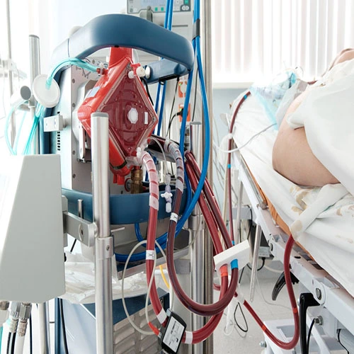 ECMO-Management